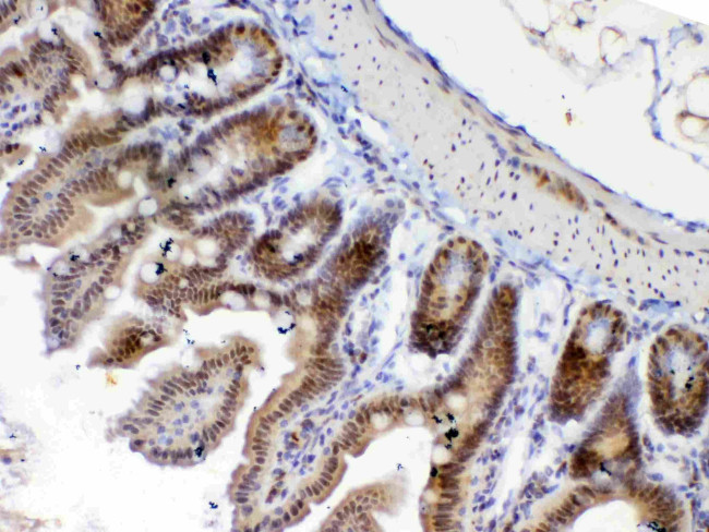 ETV6 Antibody in Immunohistochemistry (Paraffin) (IHC (P))