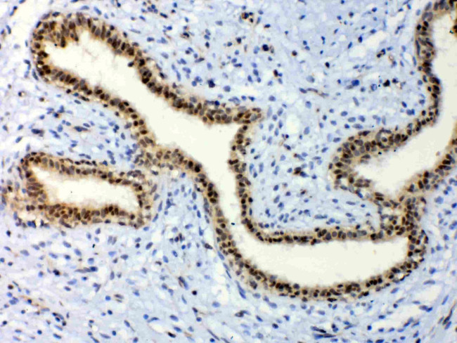 ETV6 Antibody in Immunohistochemistry (Paraffin) (IHC (P))