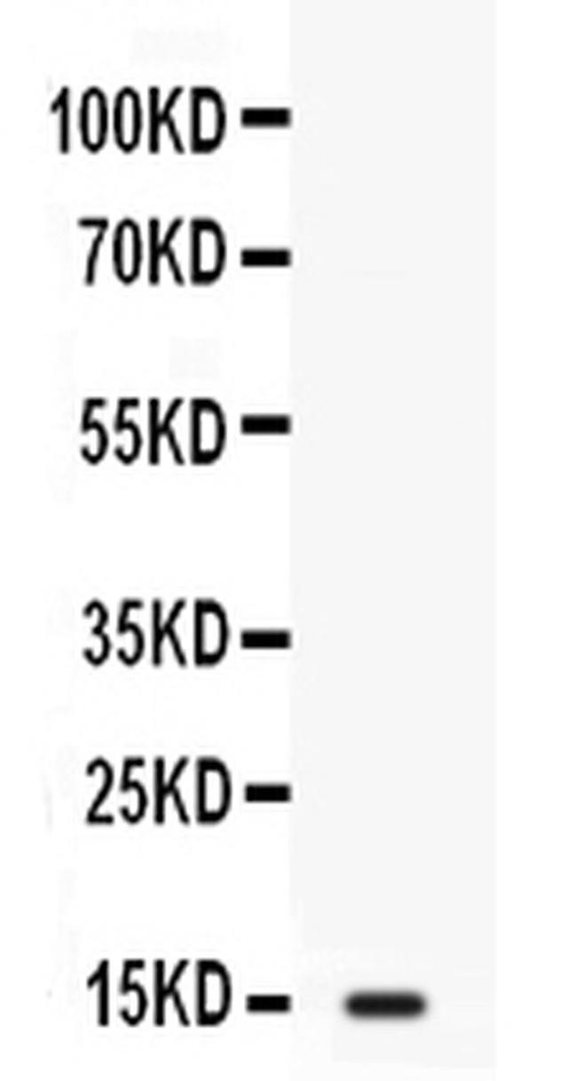 FABP2 Antibody in Western Blot (WB)