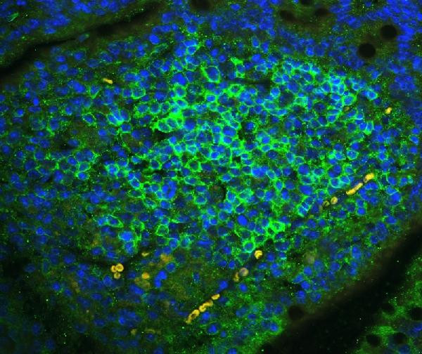 CD23 Antibody in Immunohistochemistry (Paraffin) (IHC (P))