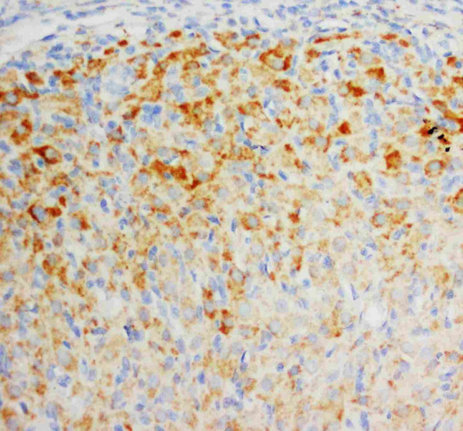 FGF8 Antibody in Immunohistochemistry (Paraffin) (IHC (P))