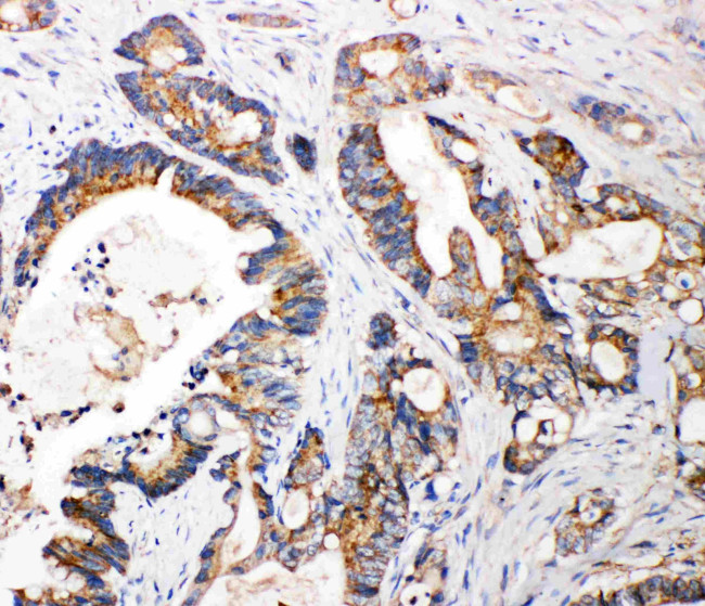 FGFR3 Antibody in Immunohistochemistry (Paraffin) (IHC (P))