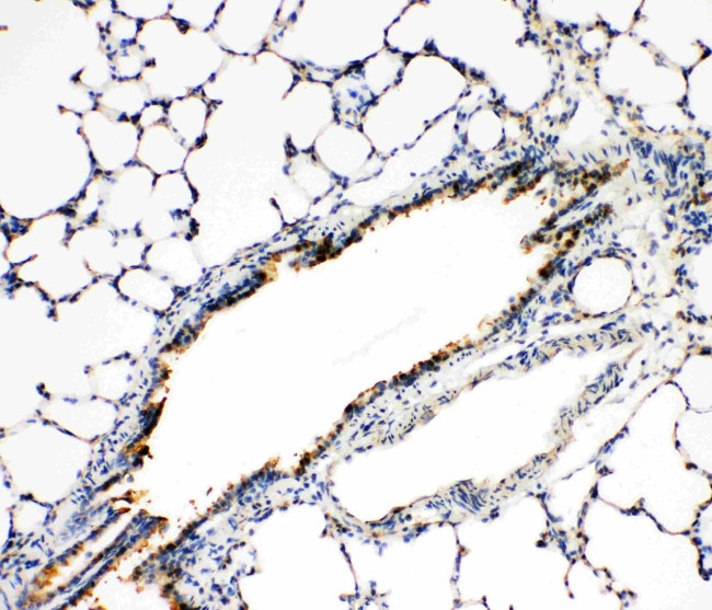 FGFR3 Antibody in Immunohistochemistry (Paraffin) (IHC (P))