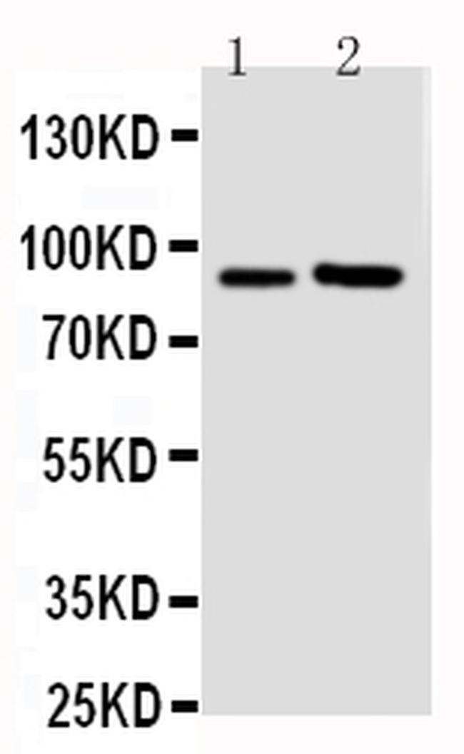 FGFR3 Antibody in Western Blot (WB)