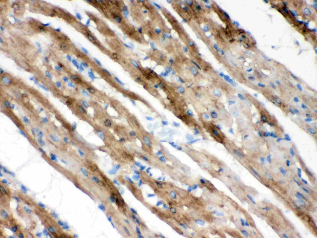 PLM Antibody in Immunohistochemistry (Paraffin) (IHC (P))