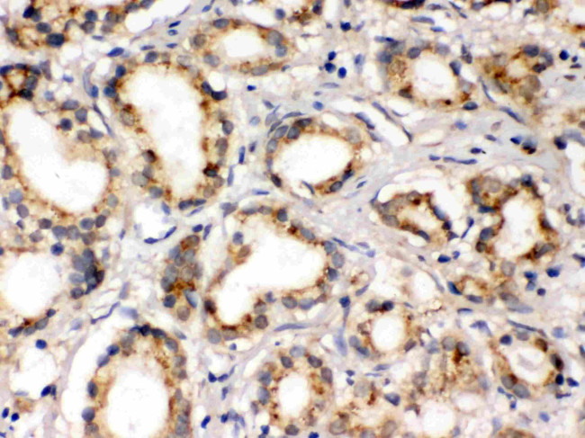 PLM Antibody in Immunohistochemistry (Paraffin) (IHC (P))