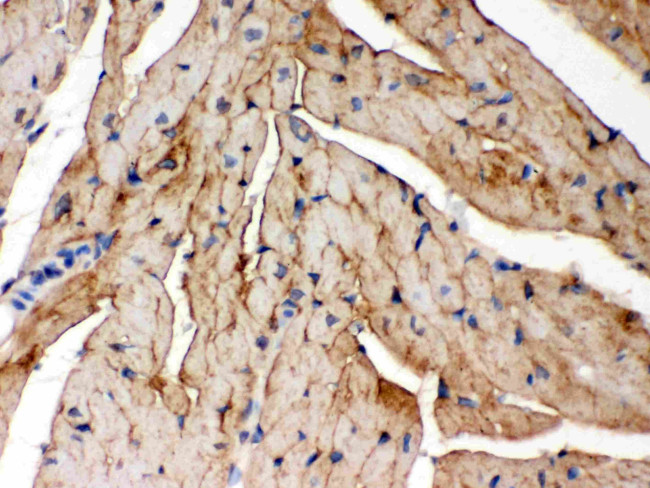 PLM Antibody in Immunohistochemistry (Paraffin) (IHC (P))