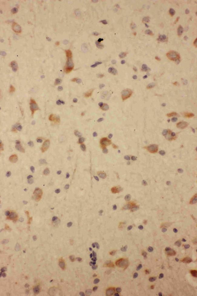 GluR2 Antibody in Immunohistochemistry (Paraffin) (IHC (P))