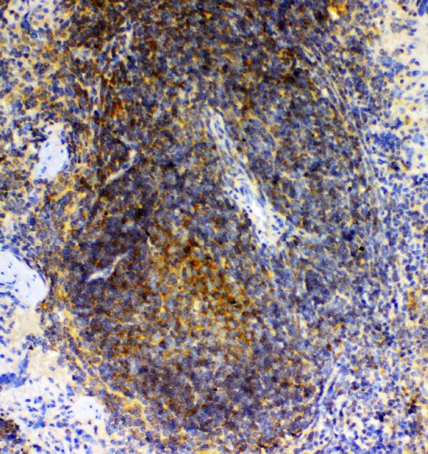 GRK2 Antibody in Immunohistochemistry (Paraffin) (IHC (P))