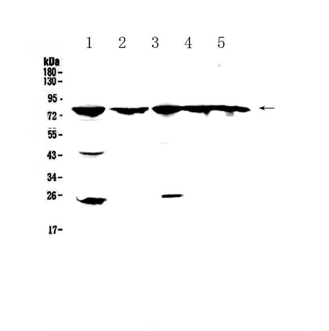 GRK2 Antibody in Western Blot (WB)