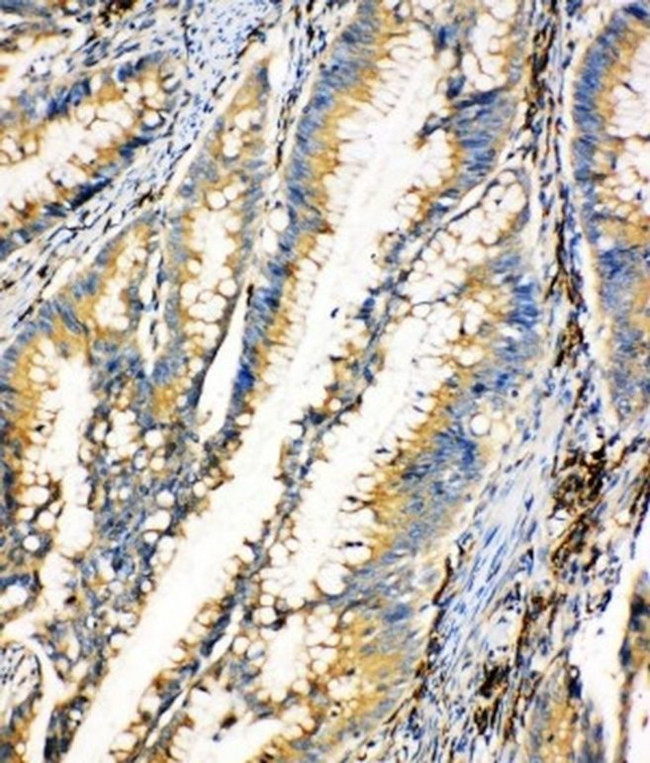 HEXA Antibody in Immunohistochemistry (Paraffin) (IHC (P))