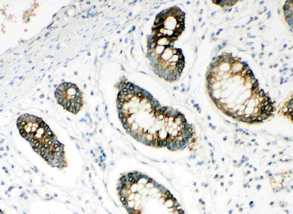 HYAL1 Antibody in Immunohistochemistry (Paraffin) (IHC (P))