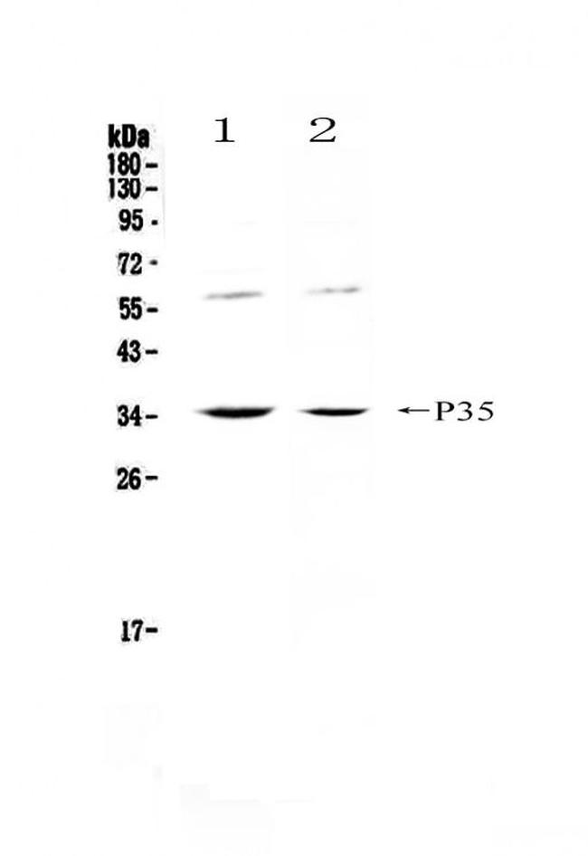 IL-12 p35 Antibody in Western Blot (WB)