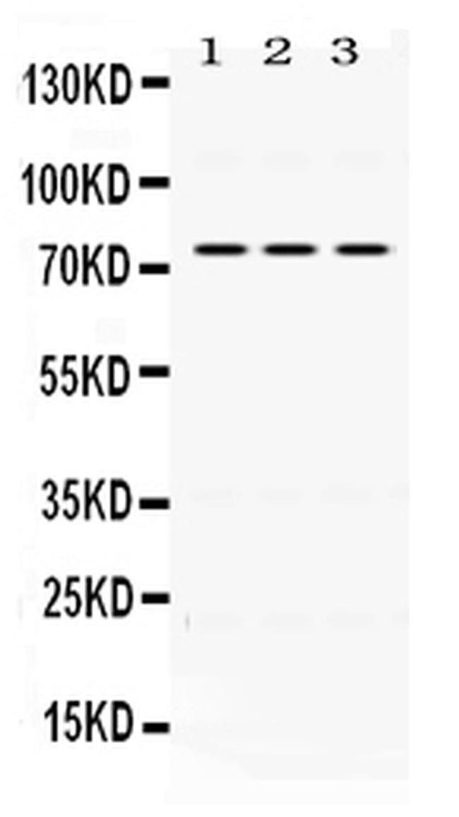 CD122 Antibody in Western Blot (WB)