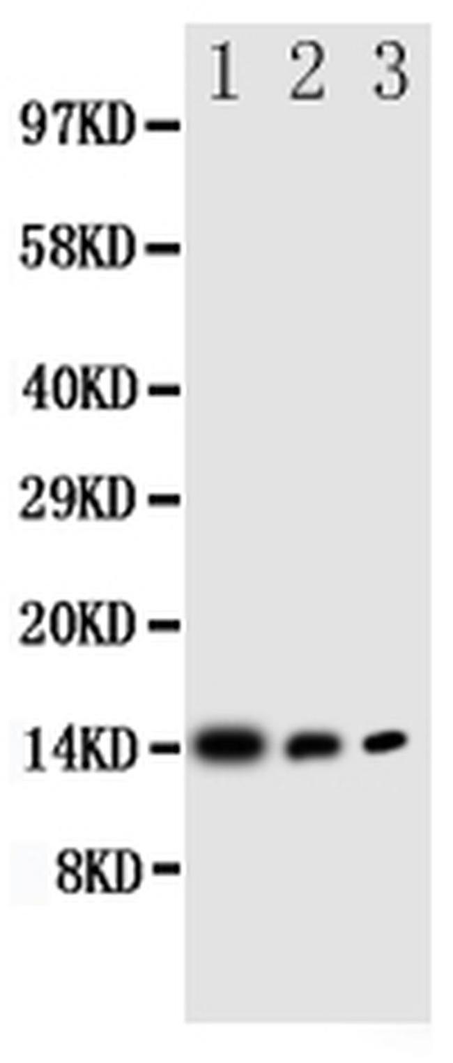 IL-4 Polyclonal Antibody (PA5-79504)