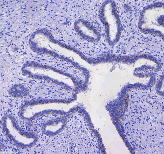 CD41 Antibody in Immunohistochemistry (Paraffin) (IHC (P))