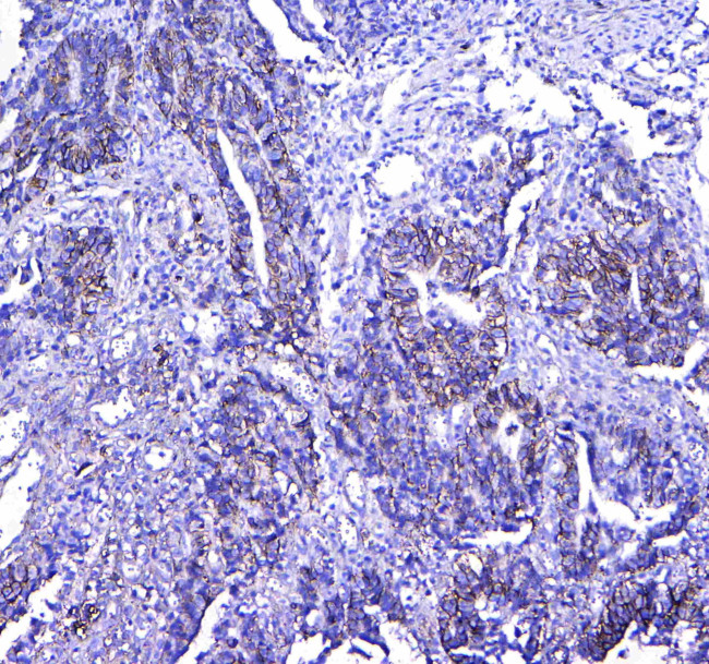 CD41 Antibody in Immunohistochemistry (Paraffin) (IHC (P))