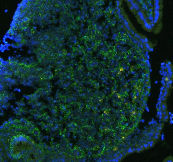 CD41 Antibody in Immunohistochemistry (Paraffin) (IHC (P))