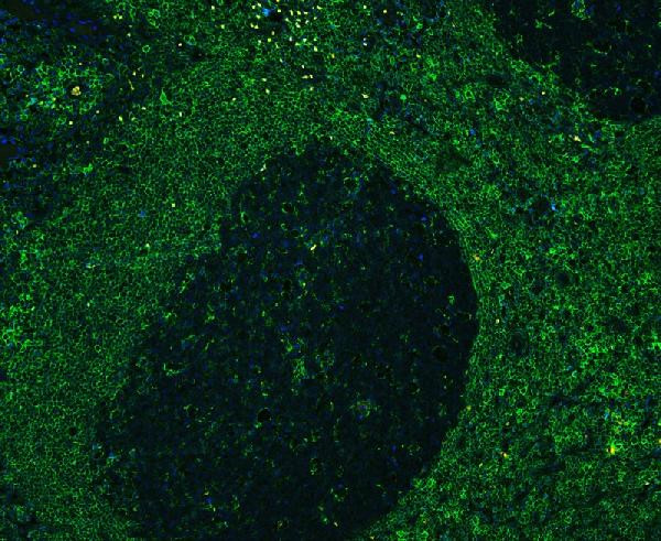 CD41 Antibody in Immunohistochemistry (Paraffin) (IHC (P))