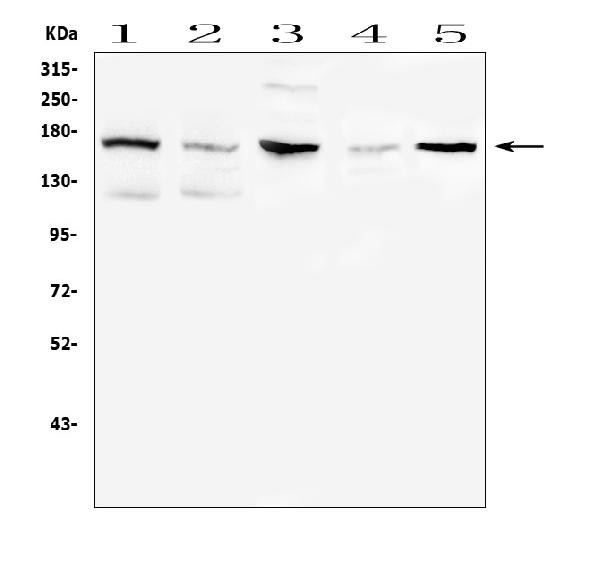 CD41 Antibody in Western Blot (WB)