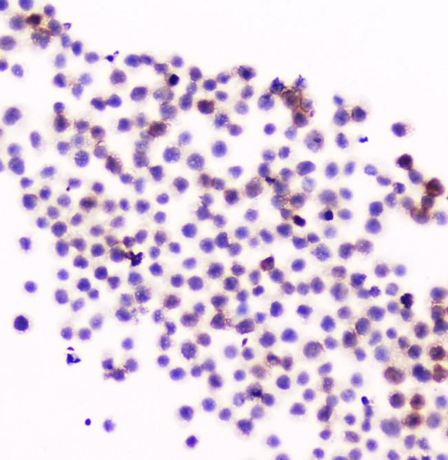 CD11a Antibody in Immunocytochemistry (ICC/IF)