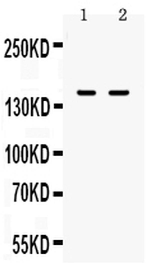 CD11a Antibody in Western Blot (WB)