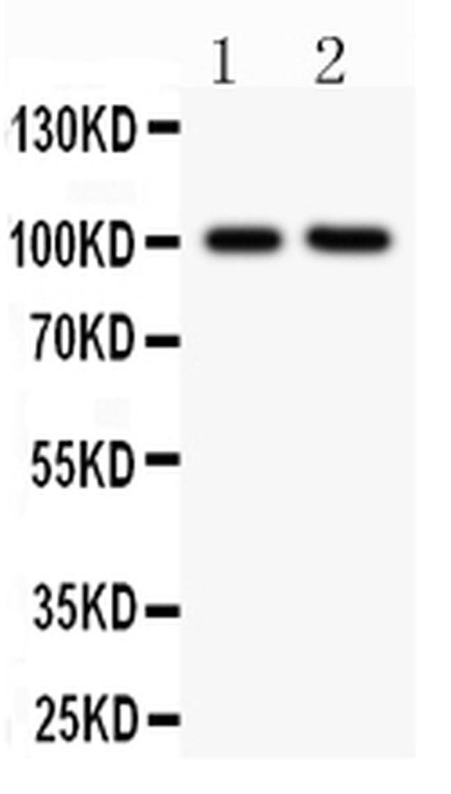 CD18 Antibody in Western Blot (WB)