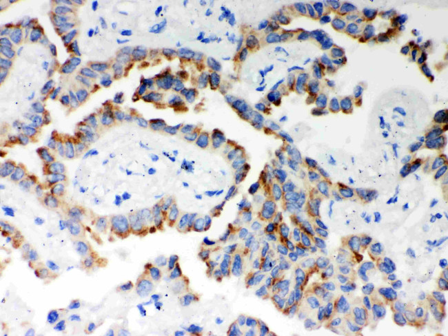 ITPR3 Antibody in Immunohistochemistry (Paraffin) (IHC (P))