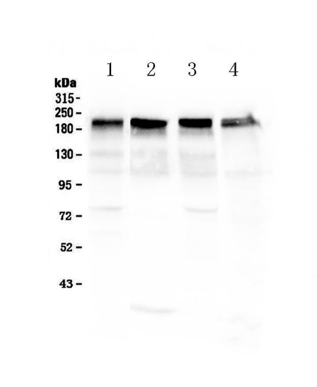 Laminin gamma-1,2,3 Antibody in Western Blot (WB)