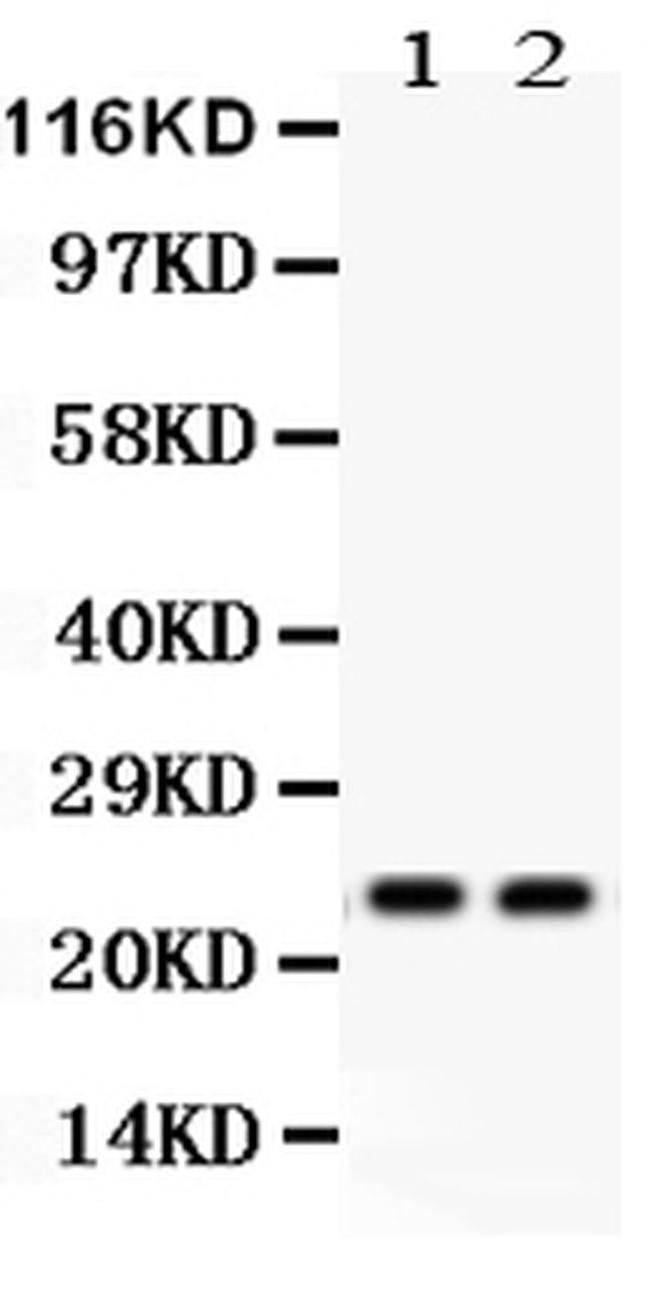 NGAL Antibody in Western Blot (WB)