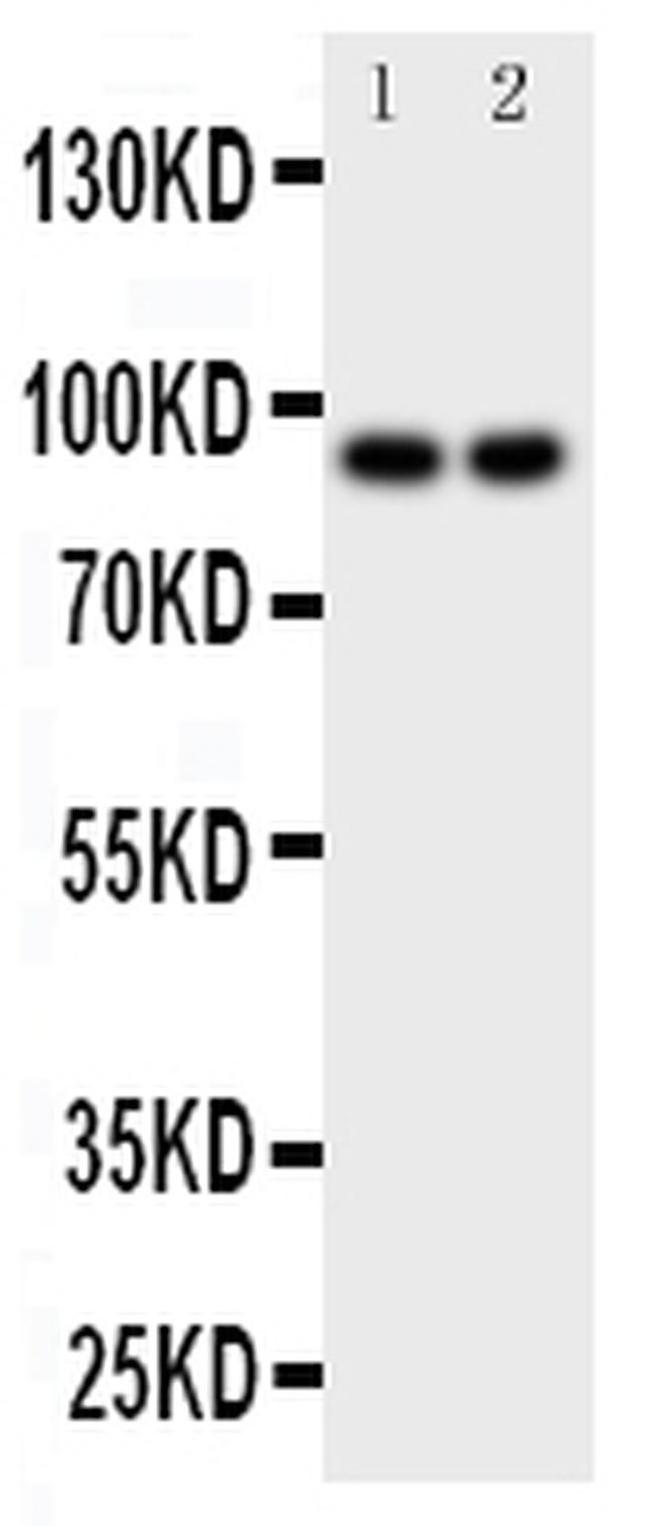 MALT1 Antibody in Western Blot (WB)