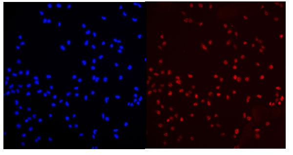 PCQAP Antibody in Immunocytochemistry (ICC/IF)