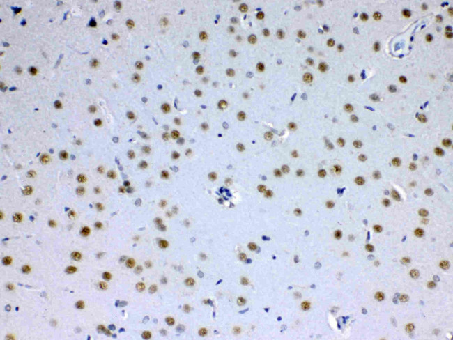 PCQAP Antibody in Immunohistochemistry (Paraffin) (IHC (P))