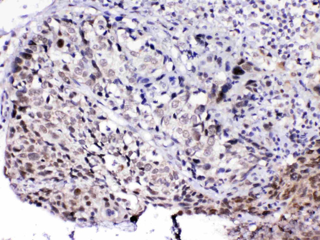 PCQAP Antibody in Immunohistochemistry (Paraffin) (IHC (P))