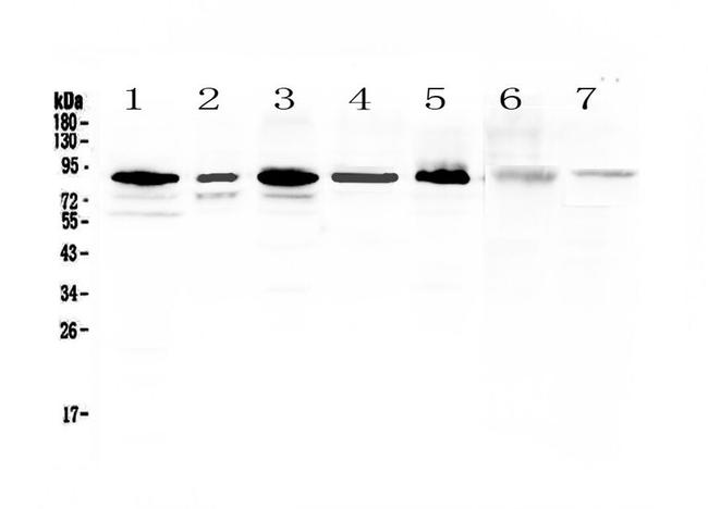 PCQAP Antibody in Western Blot (WB)