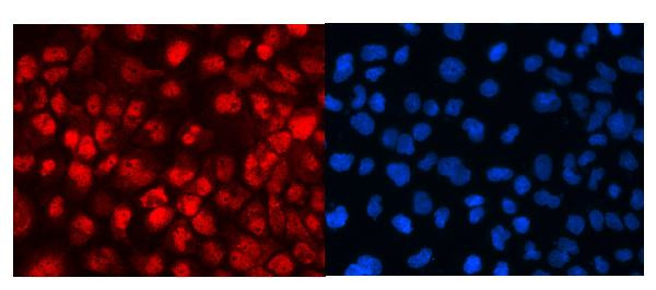 MED18 Antibody in Immunocytochemistry (ICC/IF)