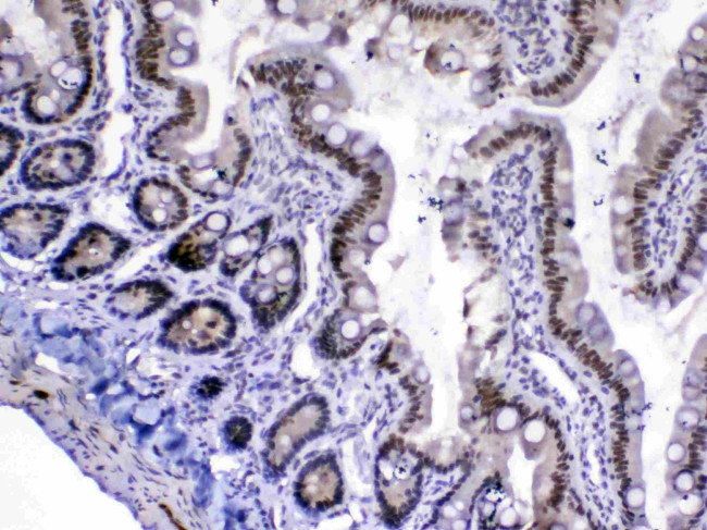 MED18 Antibody in Immunohistochemistry (Paraffin) (IHC (P))