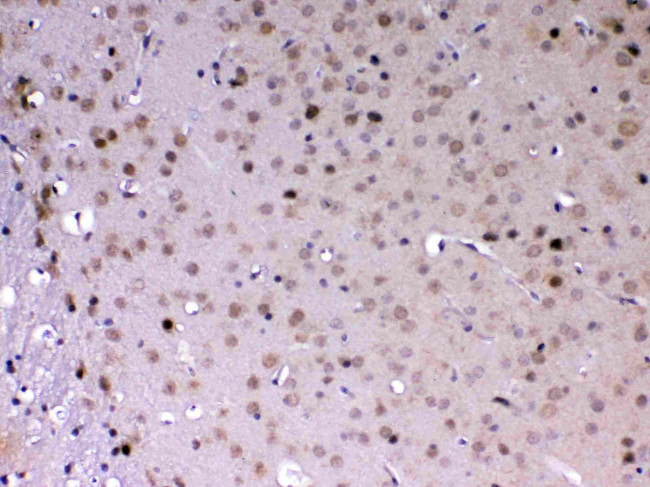 MED18 Antibody in Immunohistochemistry (Paraffin) (IHC (P))