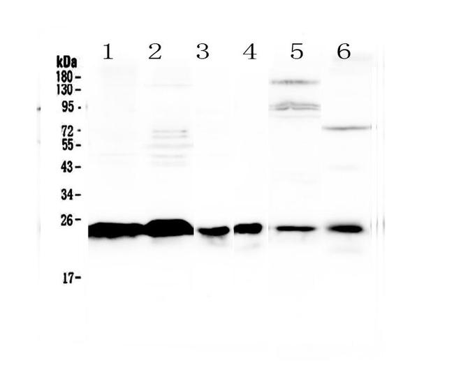 MED18 Antibody in Western Blot (WB)