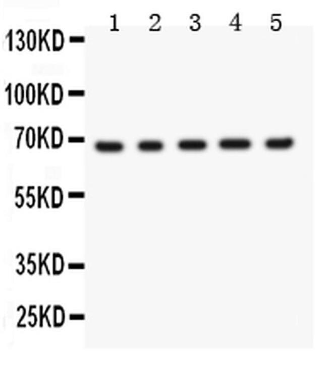 Menin Antibody in Western Blot (WB)