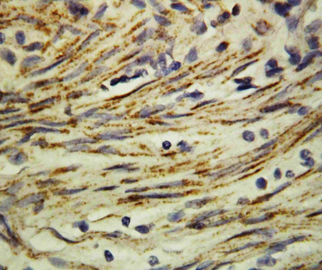 MMP16 Antibody in Immunohistochemistry (Paraffin) (IHC (P))