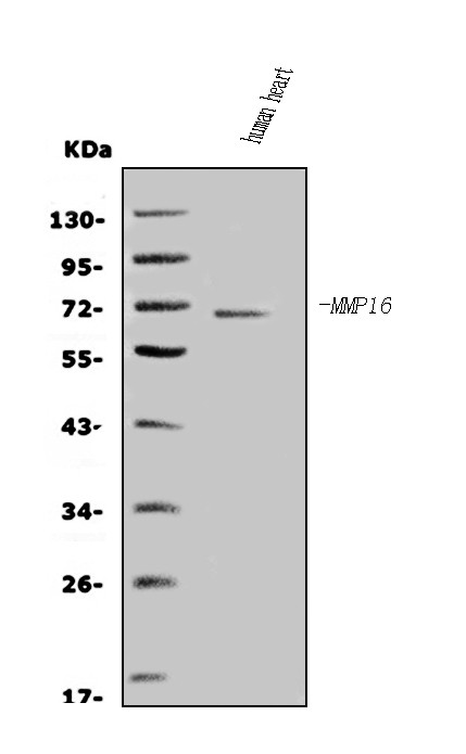 MMP16 Antibody in Western Blot (WB)