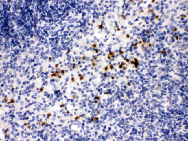 MMP8 Antibody in Immunohistochemistry (Paraffin) (IHC (P))