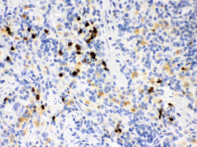 MMP8 Antibody in Immunohistochemistry (Paraffin) (IHC (P))