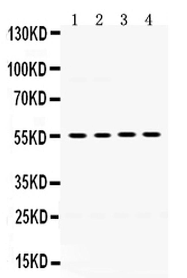 MMP8 Antibody in Western Blot (WB)