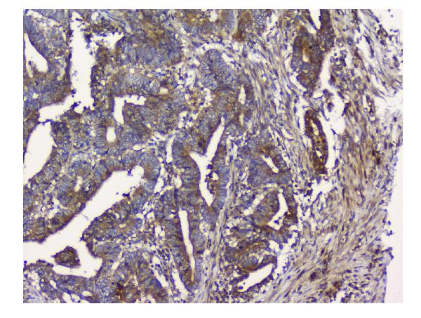 NMI Antibody in Immunohistochemistry (Paraffin) (IHC (P))