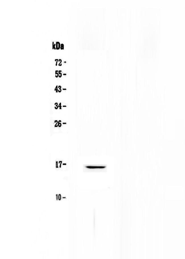 NPC2 Antibody in Western Blot (WB)