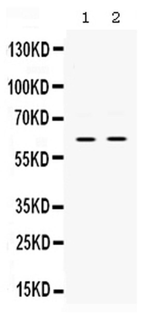 PAK3 Antibody in Western Blot (WB)