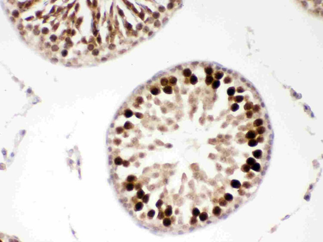 PBK Antibody in Immunohistochemistry (Paraffin) (IHC (P))