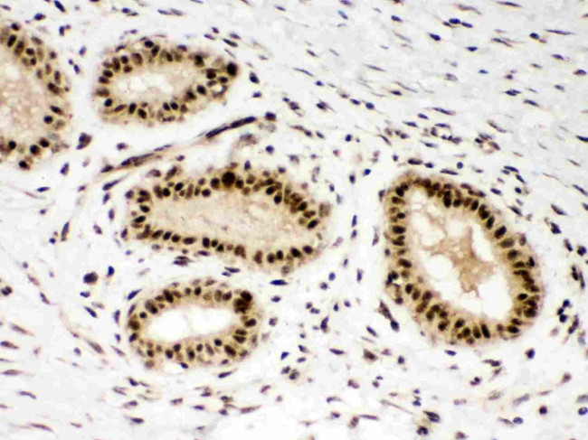 PBK Antibody in Immunohistochemistry (Paraffin) (IHC (P))